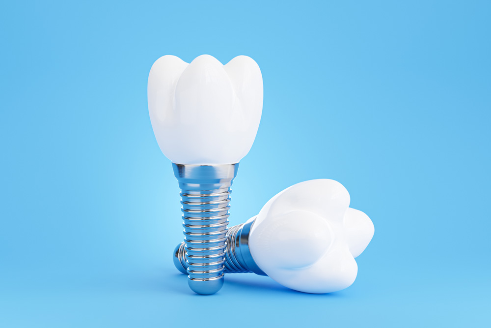 3 Key Differences Between a Dental Implant vs Bridge